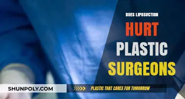 Does Liposuction Hurt Surgeons? Exploring the Physical Toll of Plastic Surgery