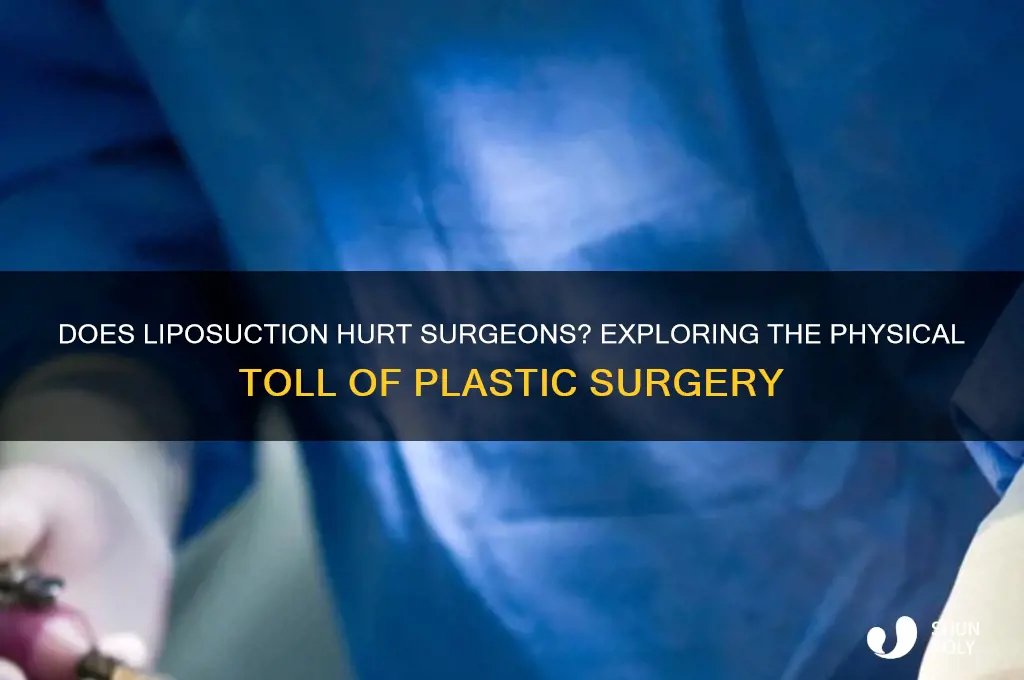 does liposuction hurt plastic surgeons