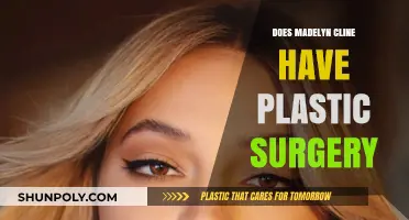 Madelyn Cline Plastic Surgery: Fact-Checking the Rumors and Speculations