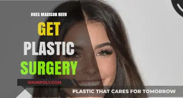 Madison Beer Plastic Surgery: Fact-Checking Rumors and Speculations
