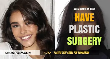 Madison Beer Plastic Surgery: Fact-Checking Rumors and Speculations