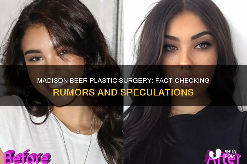 does madison beer have plastic surgery