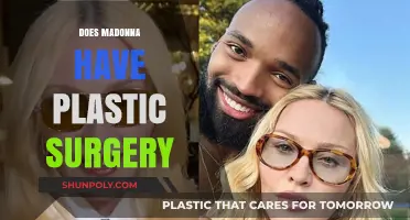 Madonna's Transformation: Unveiling the Truth About Her Plastic Surgery