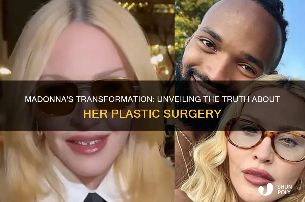 does madonna have plastic surgery