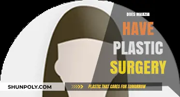 Marzia's Transformation: Unveiling the Truth About Plastic Surgery Rumors