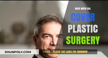 Does Medi-Cal Cover Plastic Surgery? What You Need to Know