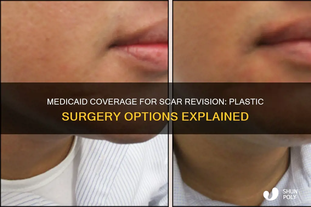 does medicaid cover plastic surgery for scars