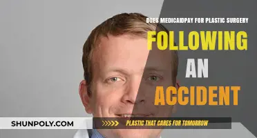Does Medicaid Cover Plastic Surgery After Accidents? What You Need to Know