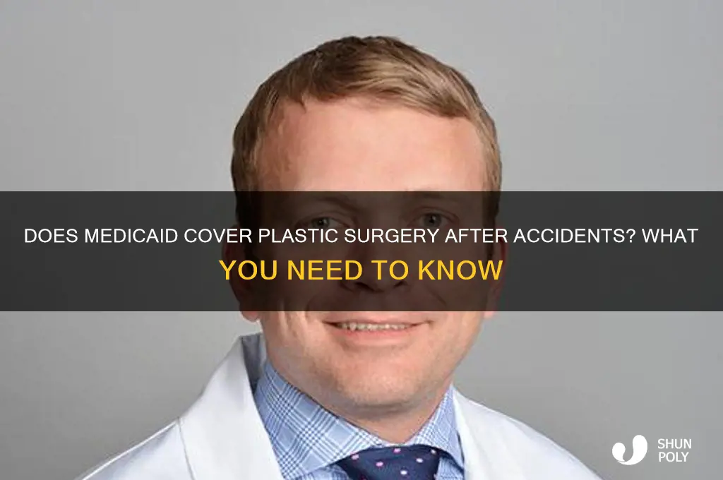 does medicaidpay for plastic surgery following an accident