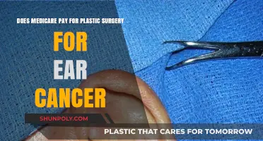 Medicare Coverage for Ear Cancer Plastic Surgery: What You Need to Know