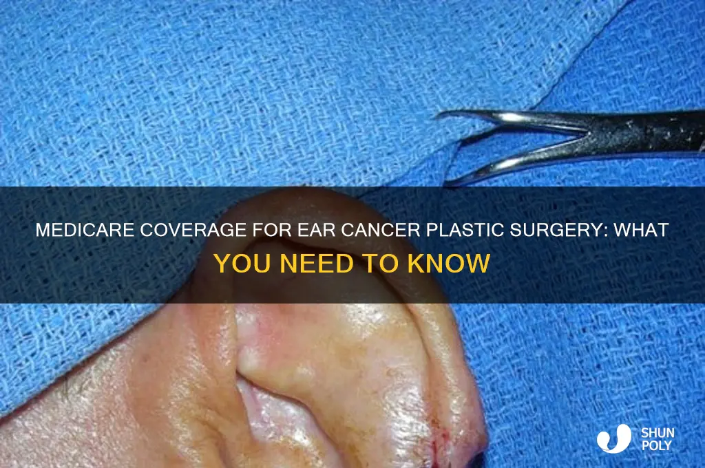 does medicare pay for plastic surgery for ear cancer