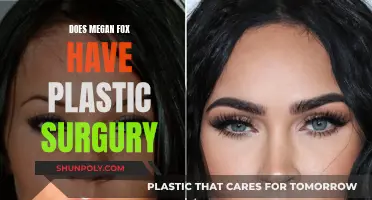 Megan Fox's Plastic Surgery: Fact or Fiction?