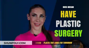 Megan's Transformation: Plastic Surgery Speculations and the Truth Revealed