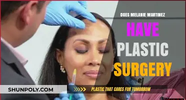 Melanie Martinez Plastic Surgery: Fact-Checking the Rumors and Speculations