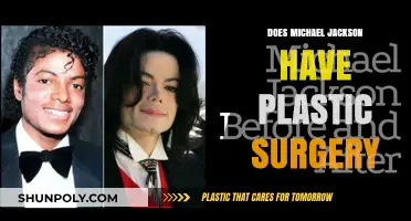 Michael Jackson's Transformation: Unveiling the Truth About Plastic Surgery