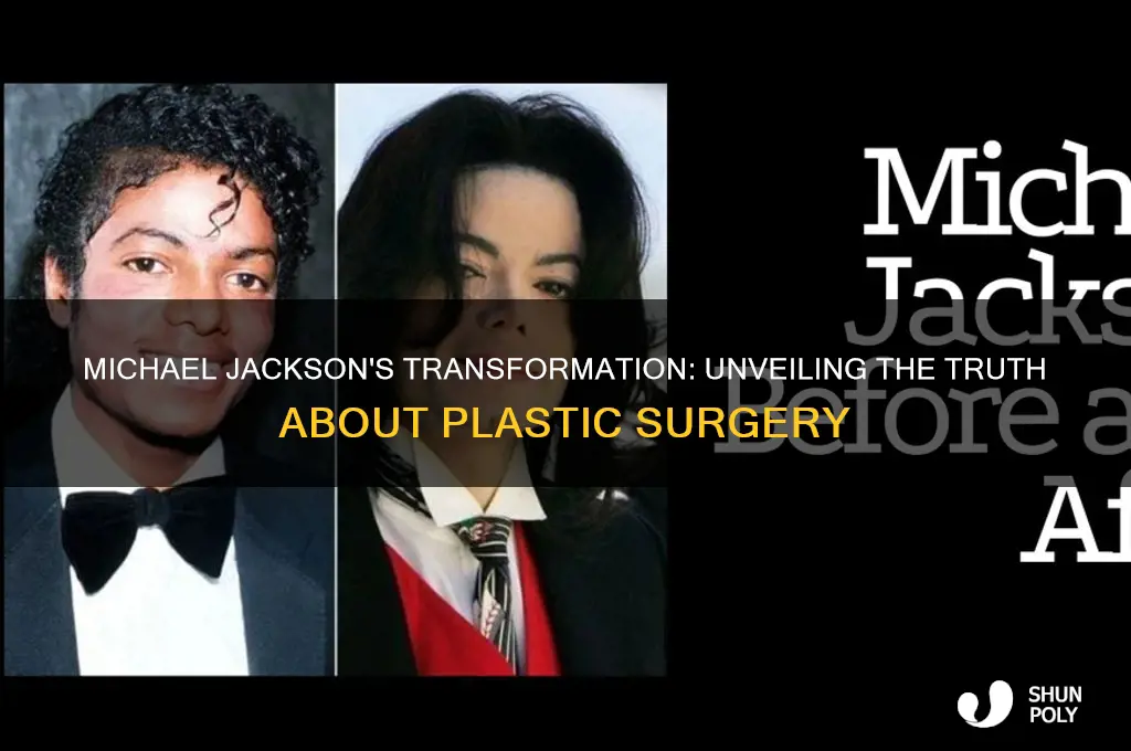 does michael jackson have plastic surgery