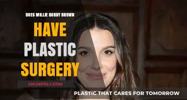 Millie Bobby Brown Plastic Surgery Rumors: Fact or Fiction?