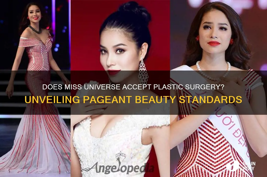 does miss universe allow plastic surgery