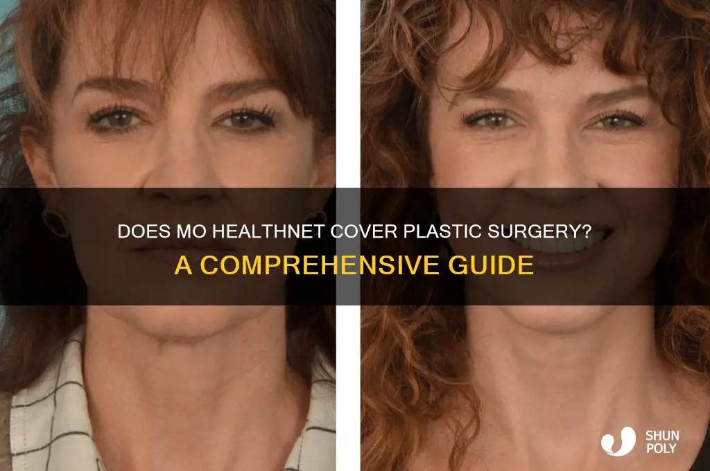 does mo healthnet cover plastic surgery