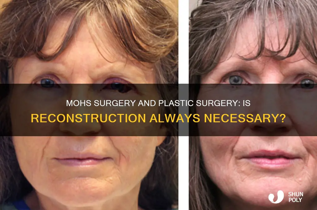 does mohs surgery always require plastic surgery