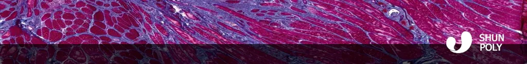 does muscle plasticity decrease with age