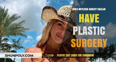 Neyleen Ashley Calejo's Transformation: Plastic Surgery Speculations Explored