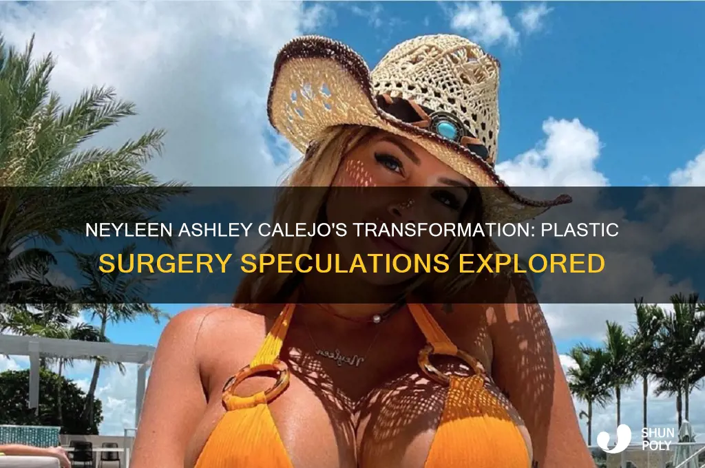does neyleen ashley calejo have plastic surgery