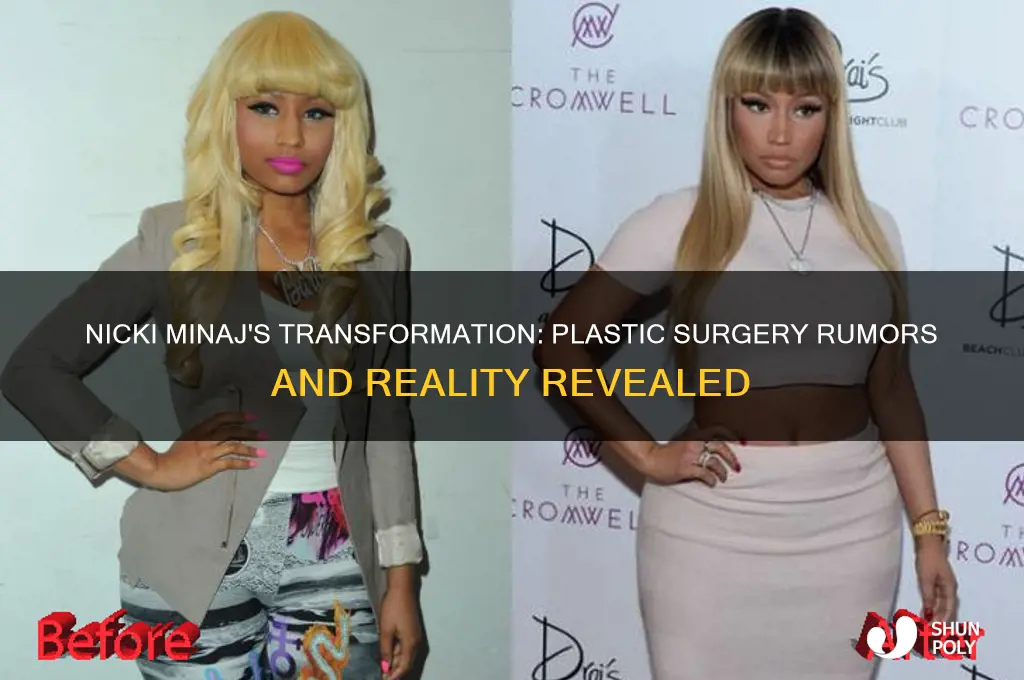 does niki minaj have plastic surgery