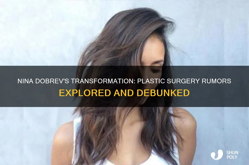 does nina dobrev have plastic surgery