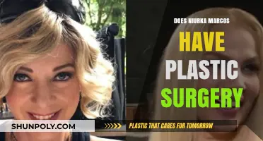 Niurka Marcos Plastic Surgery: Fact or Fiction? Unveiling the Truth