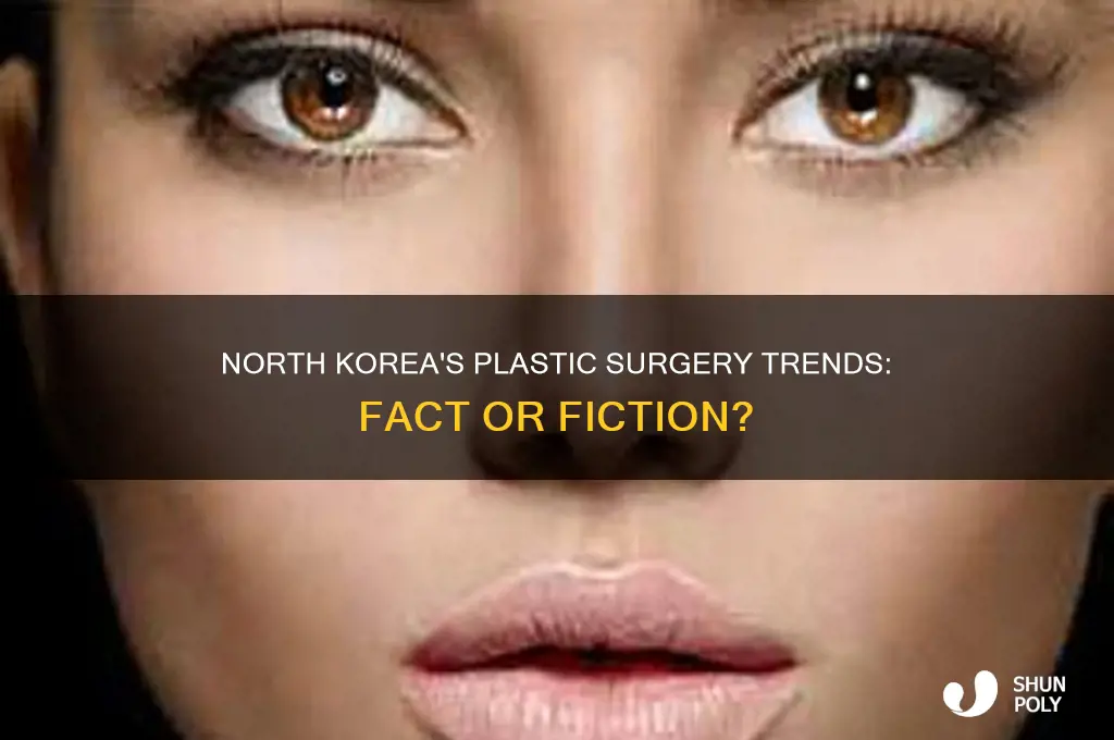 does north korea have a lot of plastic surgery