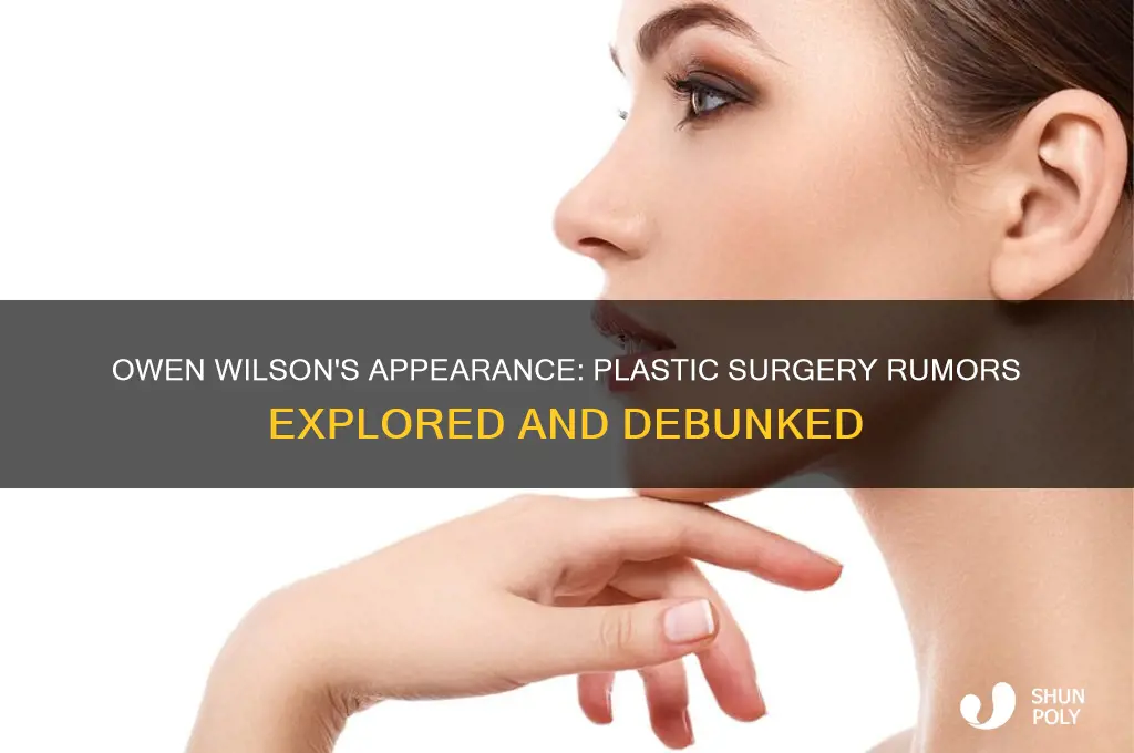 does owen wilson have plastic surgery