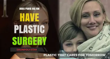 Paris Hilton's Transformation: Plastic Surgery Rumors and Reality Revealed