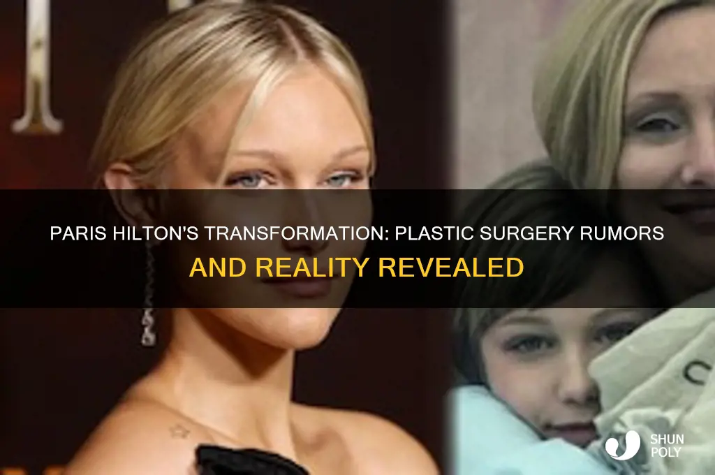 does paris hilton have plastic surgery