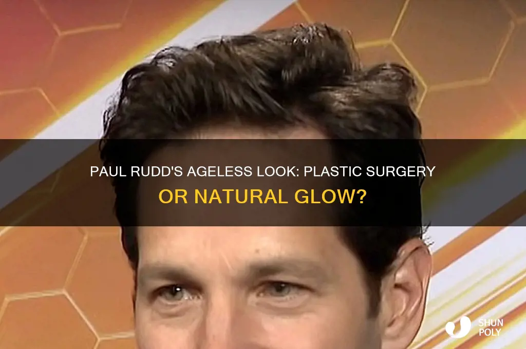 does paul rudd get plastic surgery