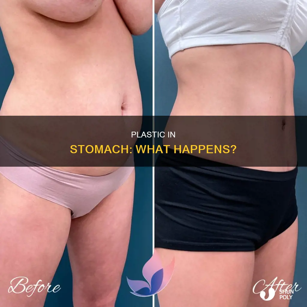does plastic dissolve in your stomach