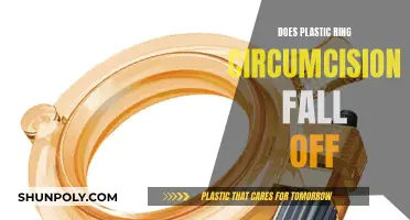 Plastic Ring Circumcision: What's the Deal with the Falling Off?
