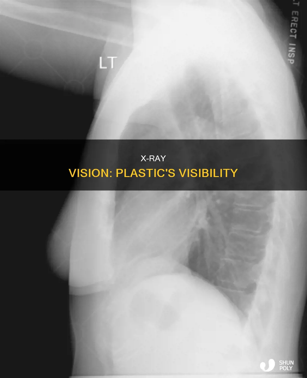 does plastic show on an xray