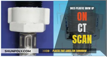 Plastic and CT Scans: What You Need to Know
