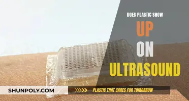 Plastic in Body: Ultrasound Detection