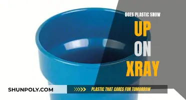 X-ray Vision: Can Plastic Be Detected?