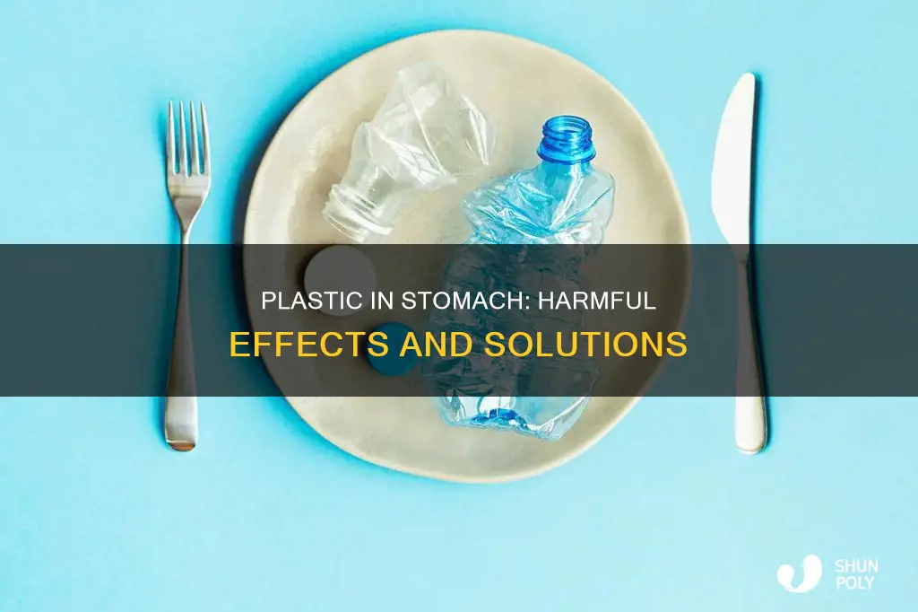 does plastic stay in your stomach