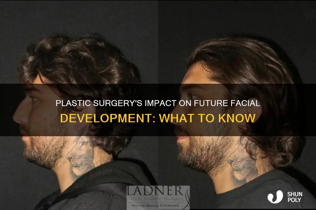 does plastic surgery affect the future development of your face
