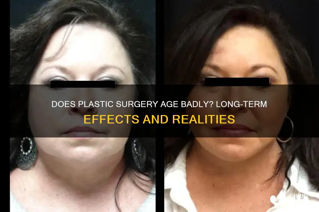 does plastic surgery age badly
