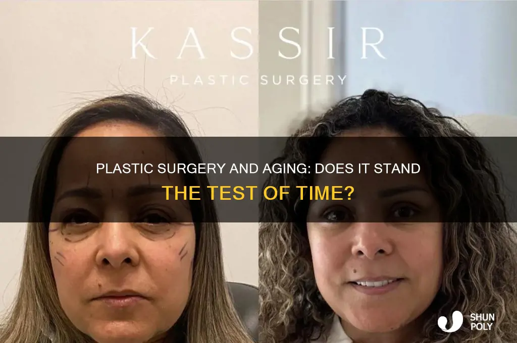 does plastic surgery age well