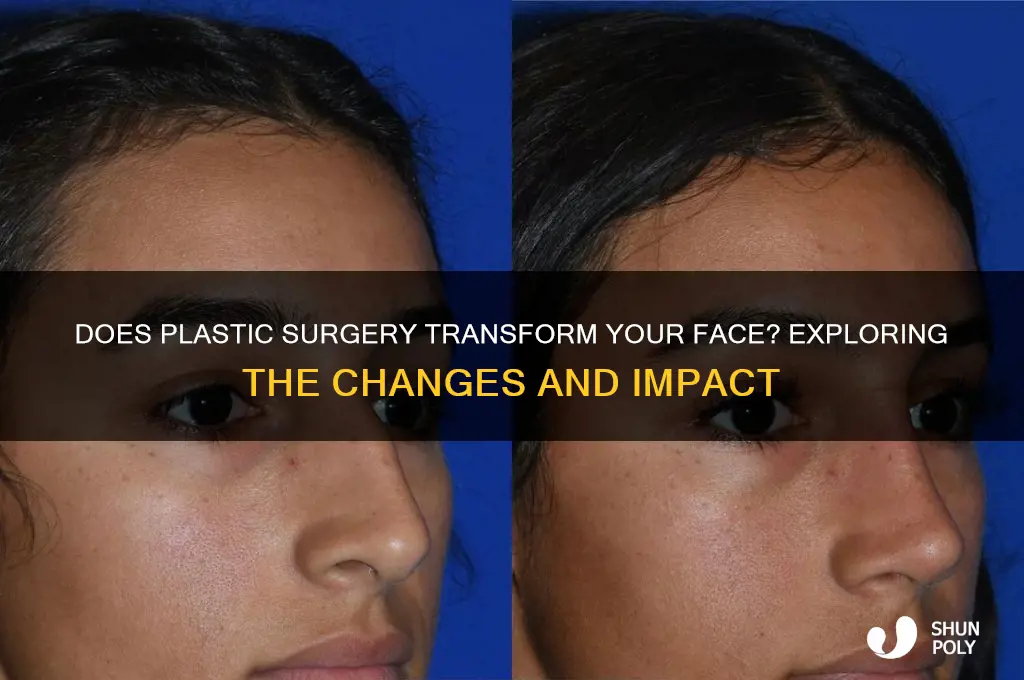 does plastic surgery change your face