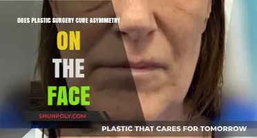 Can Plastic Surgery Correct Facial Asymmetry? Facts and Considerations