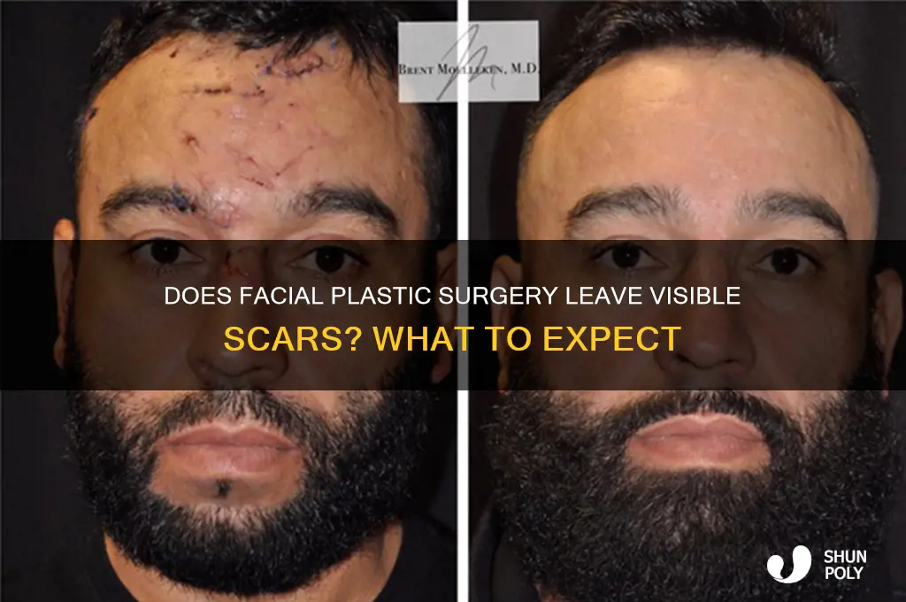 does plastic surgery cut on face