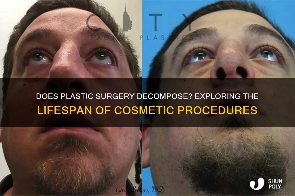 does plastic surgery decompose