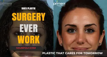 Does Plastic Surgery Deliver Real Results? Separating Fact from Fiction